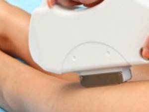 لیزر موهای زائد SHR (Super Hair Removal)