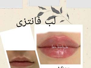 ژل لب فانتزی در بوشهر