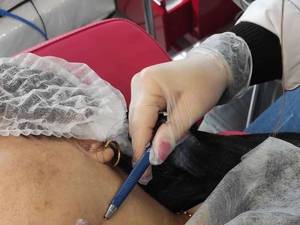 انجام الکترولیز