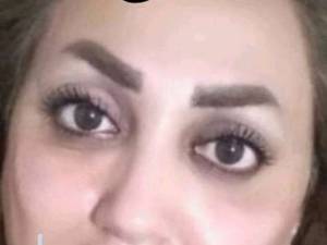 ژل گونه ولب در بوشهر