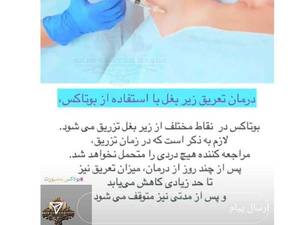رفع عرق زیر بغل در بوشهر کلینیک فیس بیوتی