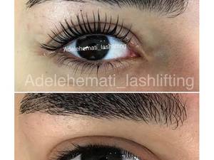 لیفت مژه