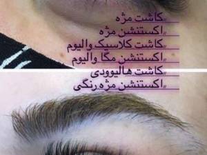 کاشت مژه حرفه ای در مازندران