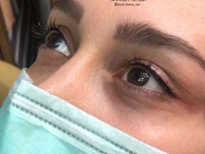 میکروبلیدینگ ستاره سیدی در رشت