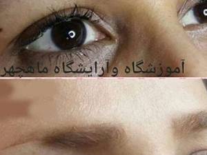 انجام میکروبلیدینگ ابرو