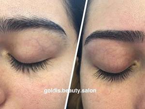 اصلاح  و قرینه سازی ابرو