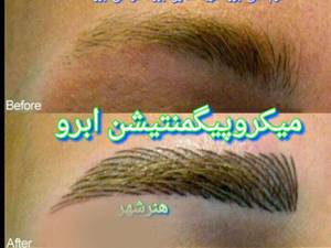 انجام  میکروپیگمنتیشن ابرو