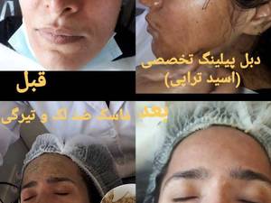 مرکز و آموزشگاه فیشیال پوست