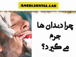 قیمت جرم گیری  اصفهان
