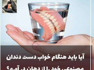دندانسازی صنعتی در اصفهان