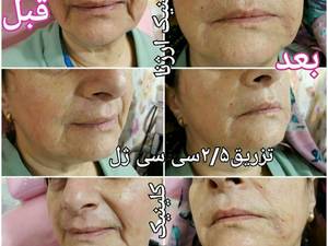 کلینیک مجهز زیبائی و تناسب اندام ارژنا