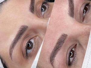 قرینه سازی ابرو به روش فیبروز  و نانو فیبروز در قزوین