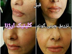 کلینیک مجهز زیبائی و تناسب اندام ارژنا