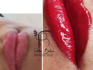 انجام کانتور دائم لب  در چالوس