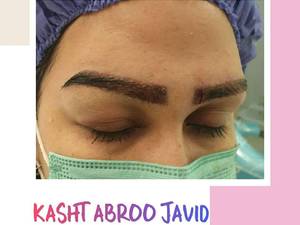 کاشت ابروی طبیعی در یکروز  در شیراز