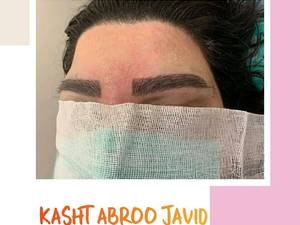 کاشت ابروی طبیعی در یکروز  در شیراز