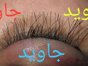 کاشت مژه به روش fut در شیراز