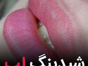 آموزش تخصصی شیدینگ لب در غرب تهران