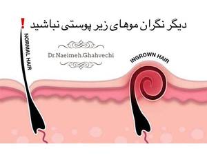 علت موهای زیر پوستی