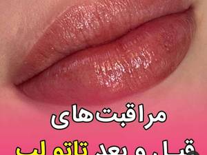 انجام و آموزش کانتورینگ لب در غرب تهران