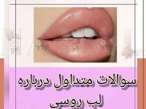 ماندگاری تزریق ژل لب مدل روسی در تهران