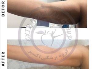جوانسازی پوست در بهترین کلینیک لاغری در مشهد