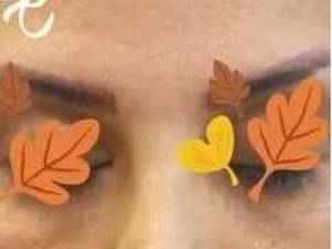 انجام آموزش لیفت صورت در تهران اکباتان