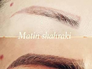 میکروبلیدینگ ابرو