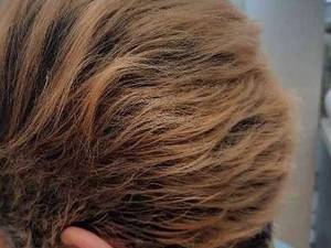 کوتاهی مدل ترکیبی کرنلی با موزر