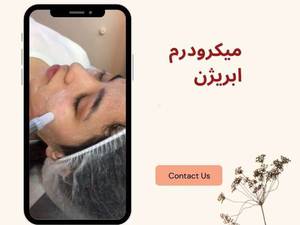 ميكرودرم ابريژن