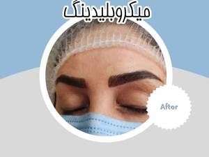 میکرو بلیدینگ  ابرو در بوشهر