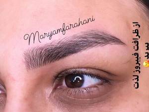بهترین فیبروز ابرو در خرم اباد