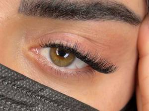 اجرای کاشت موقت خط چشم در تهران