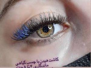 کاشت مژه هیدن در قائمشهر