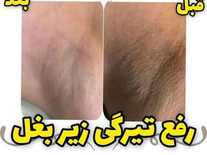 تیرگی هاتو از بین ببر
