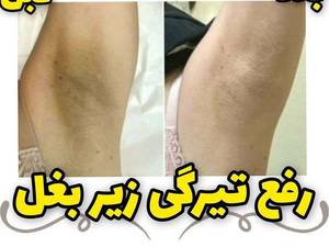 با تیرگی هات خداحافظی کن