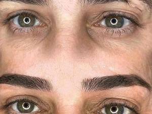 اصلاح شکستگی ابرو با تاتو حرفه ای در کرج