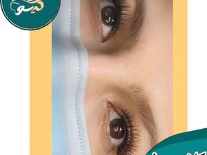 کاشت مژه موقت نچرال در تهران