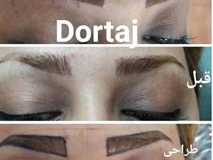 میکروبلیدینگ ابرو