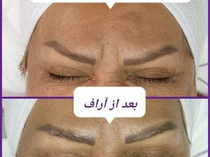 بهترین کلینیک جوانسازی پوست در ارومیه