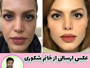 ۱۳ روش خانگی چاقی صورت