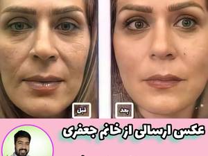 ۱۳ روش خانگی چاقی صورت