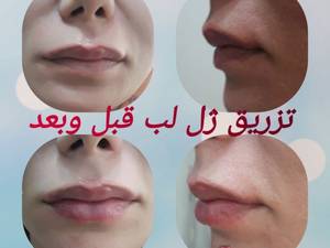 مرکز پوست ، مو، زیبایی و لیزر " آنیوشا "