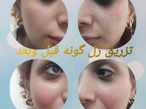 مرکز پوست ، مو، زیبایی و لیزر " آنیوشا "