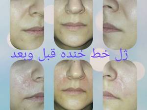 مرکز پوست ، مو، زیبایی و لیزر " آنیوشا "
