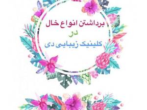 خالبرداری و زگیل برداری