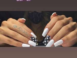 اجرای تخصصی کاشت و ترمیم ناخن
