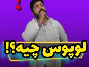 درمان بیماری لوپوس در رشت