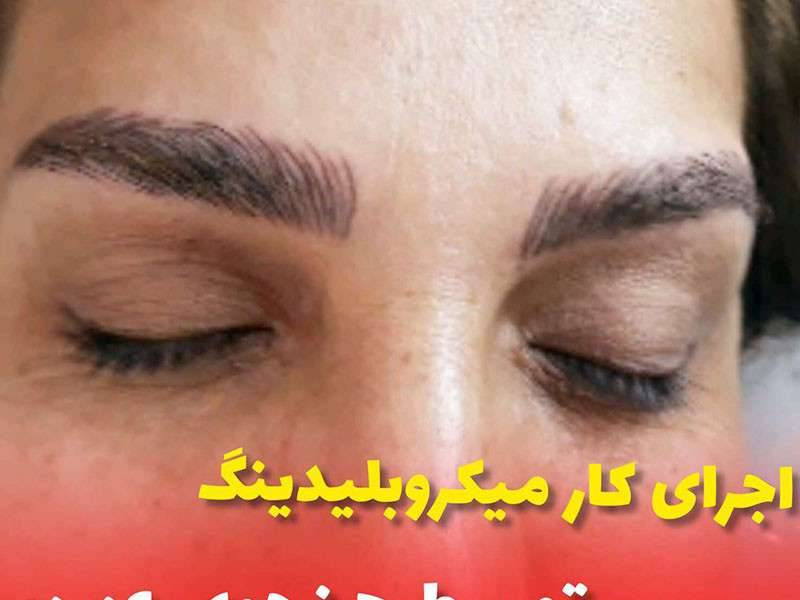 بلدبروز ابرو در صادقیه تهران