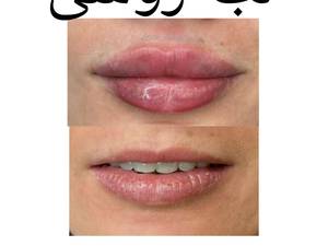 ژل لب روسی بوشهر
